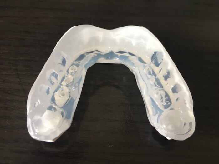 The Best Mouth Guards for Basketball in 2024 Protect Your Teeth!